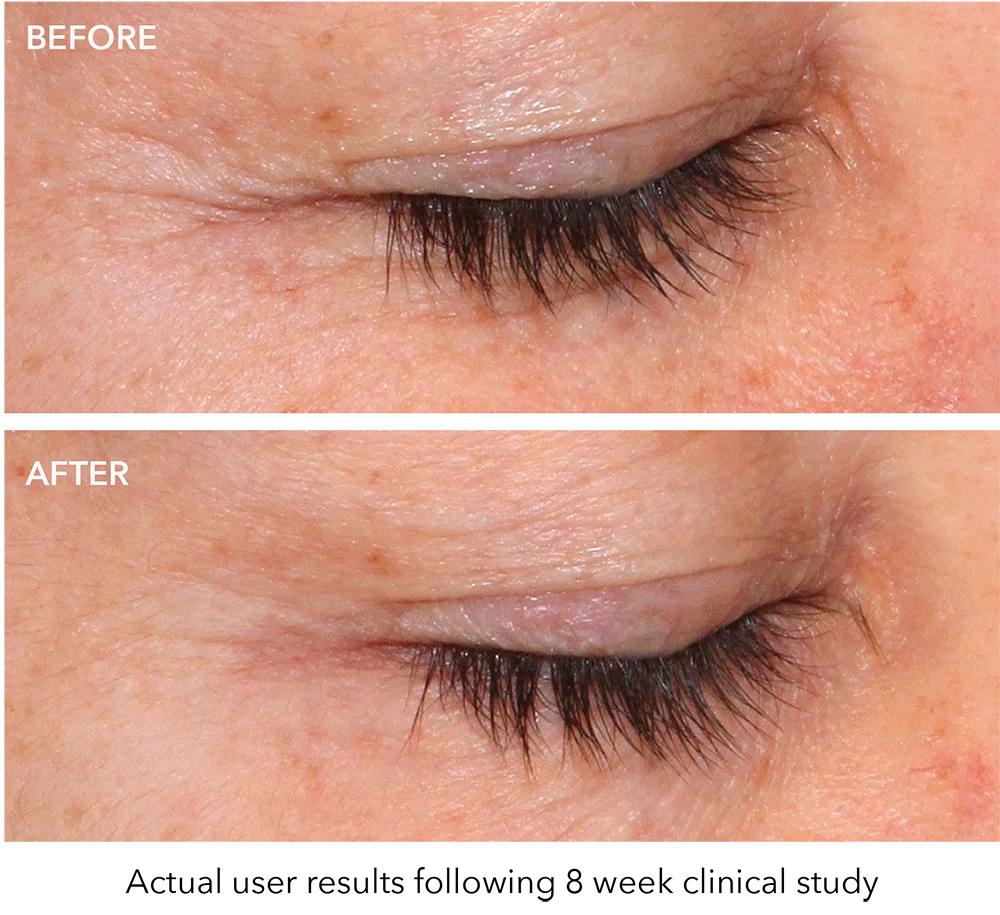 QuasarMD Plus - Image 3